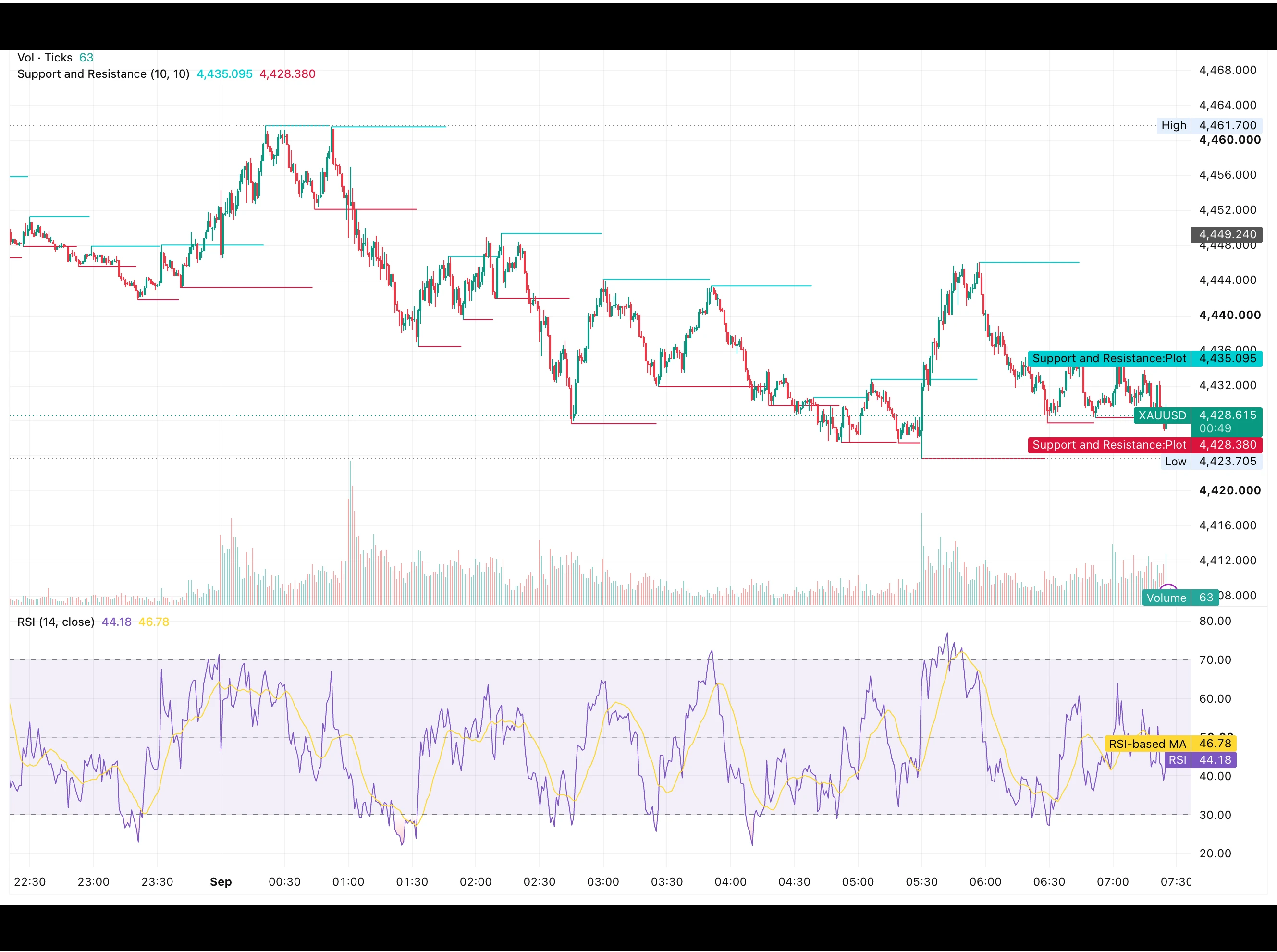 شارت تحليل الذهب اليوم XAUUSD 1 سبتمبر 2026